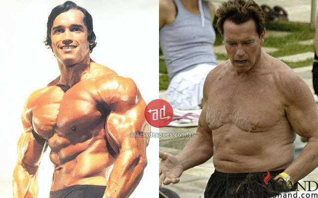 musculos_Arnold-Schwarzenegger_viejo_www.antesydespues.com.ar.jpg